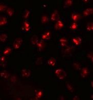 Anti-ATP2C2 antibody used in ICC/IF. GTX32009