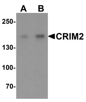Anti-CRIM2 antibody used in Western blot. GTX32086