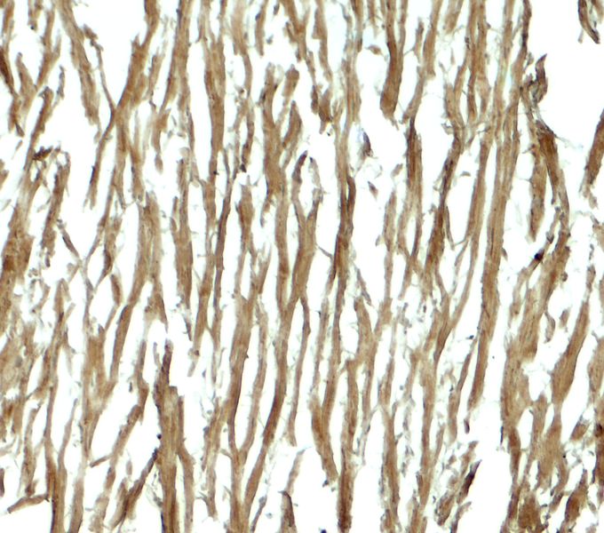 Anti-DNAJC13 antibody used in Immunohistochemistry. GTX32149