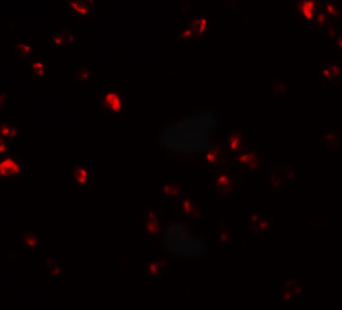 Anti-FAM193B antibody used in ICC/IF. GTX32081