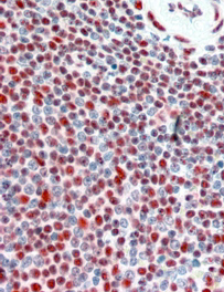 Anti-ILF2 / NF45 antibody, Internal used in IHC (Formalin-fixed paraffin-embedded sections). GTX89104