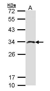 Anti-IMPA2 antibody [N1C3] used in Western blot. GTX103636