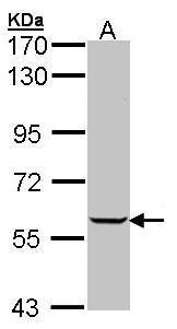 Anti-IMPDH1 antibody [N1C1] used in Western blot. GTX102814