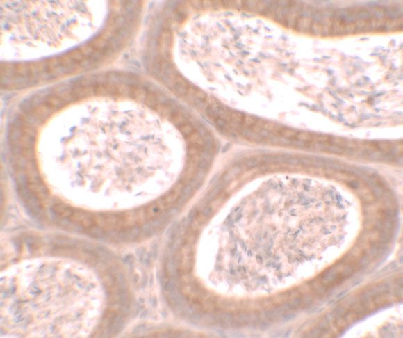 Anti-MOSPD1 antibody used in Immunohistochemistry. GTX32111