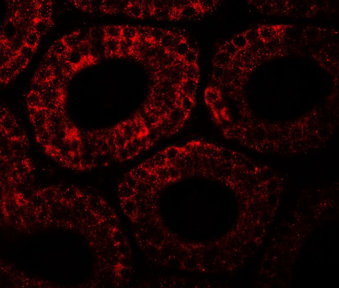 Anti-MOSPD1 antibody used in ICC/IF. GTX32111
