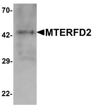 Anti-MTERFD2 antibody used in Western blot. GTX32113