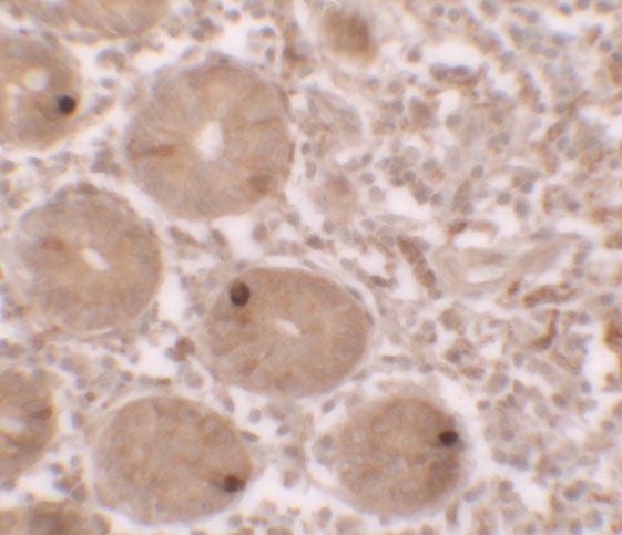 Anti-MTERFD2 antibody used in Immunohistochemistry. GTX32113