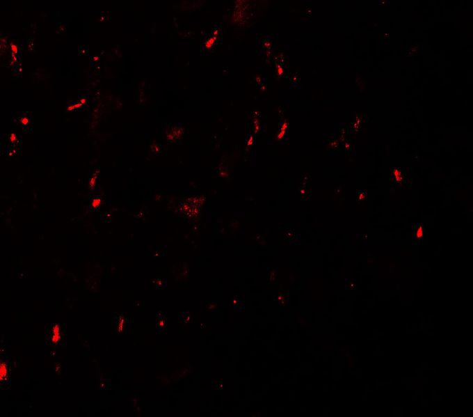 Anti-MYT1L antibody used in ICC/IF. GTX31505
