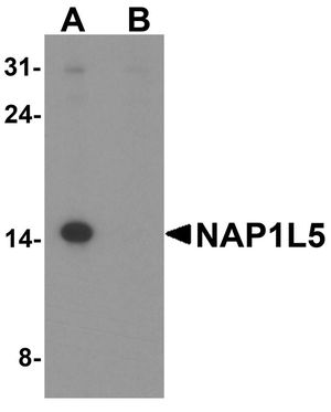 Anti-NAP1L5 antibody used in Western blot. GTX32154