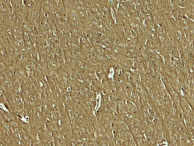 Anti-NAP1L5 antibody used in Immunohistochemistry. GTX32154