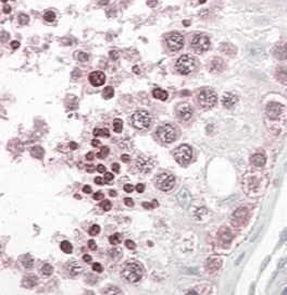 Anti-INADL / PATJ antibody, N-term used in IHC (Formalin-fixed paraffin-embedded sections). GTX28225