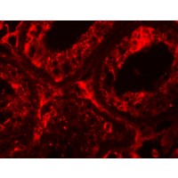 Anti-INCA1 antibody used in ICC/IF. GTX85217