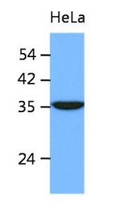 Anti-ING2 antibody [AT39E5] used in Western blot. GTX53732