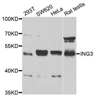 Anti-ING3 antibody used in Western blot. GTX54356