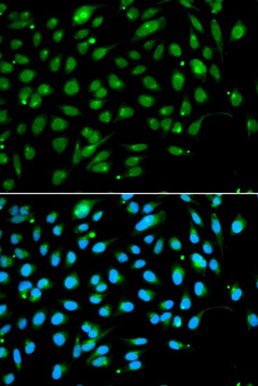 Anti-ING3 antibody used in ICC/IF. GTX54356