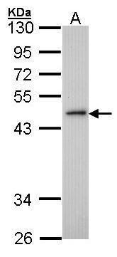 Anti-ING3 antibody [N2N3] used in Western blot. GTX102480