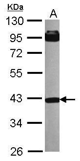 Anti-INPP5A antibody [N2C3] used in Western blot. GTX104929