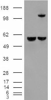 Anti-Insulysin / Insulinase antibody, Internal used in Western blot. GTX89007