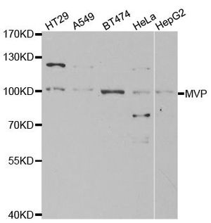 Anti-MVP antibody used in Western blot. GTX55715