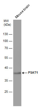 Anti-PSAT1 antibody [GT2918] used in Western blot. GTX633623