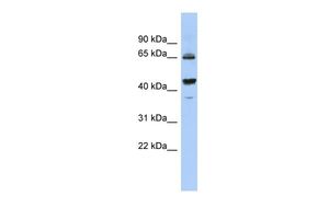 Anti-2'-PDE antibody, Internal used in Western blot. GTX45550