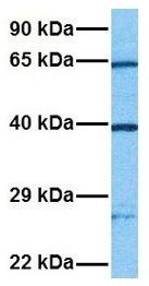 Anti-2'-PDE antibody, Internal used in Western blot. GTX45550