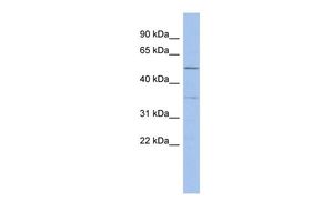 Anti-ABHD15 antibody, Internal used in Western blot. GTX45523