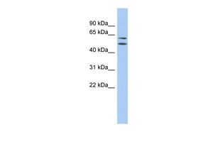 Anti-ABHD15 antibody, N-term used in Western blot. GTX45524