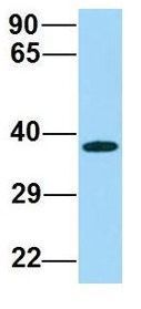 Anti-ABHD17A antibody, C-term used in Western blot. GTX16552