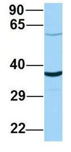 Anti-ABHD17A antibody, C-term used in Western blot. GTX16552