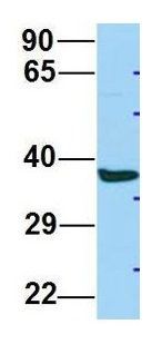 Anti-ABHD17A antibody, C-term used in Western blot. GTX16552