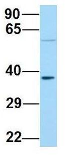 Anti-ABHD17A antibody, C-term used in Western blot. GTX16552