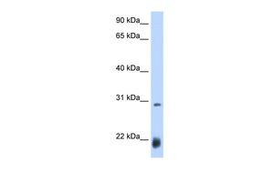Anti-AC antibody, N-term used in Western blot. GTX45854