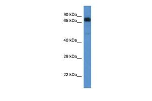 Anti-ACAD9 antibody, C-term used in Western blot. GTX48933