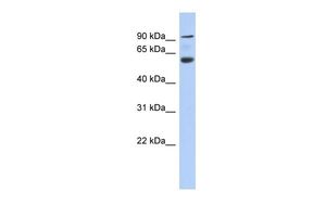 Anti-ACAP3 antibody, N-term used in Western blot. GTX45785