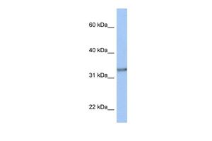 Anti-ACBD4 antibody, N-term used in Western blot. GTX45976