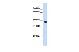 Anti-ACBD4 antibody, N-term used in Western blot. GTX45977