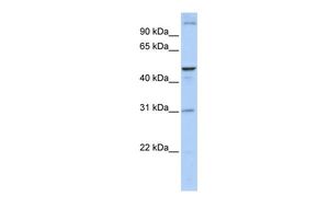 Anti-ACBD5 antibody, N-term used in Western blot. GTX46593
