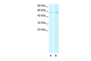 Anti-AChR alpha 2 antibody, N-term used in Western blot. GTX77709