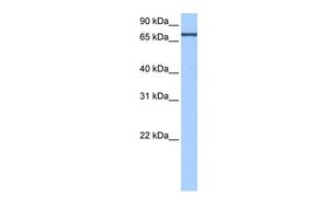 Anti-ADAD2 antibody, C-term used in Western blot. GTX47217