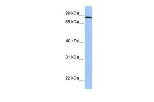 Anti-ADAM7 antibody, C-term used in Western blot. GTX45485