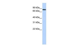 Anti-ADARB2 antibody, Internal used in Western blot. GTX47280