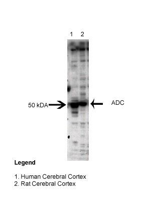 Anti-ADC antibody, Internal used in Western blot. GTX45774