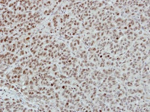 Anti-INTS4 antibody [N1N2], N-term used in IHC (Formalin-fixed paraffin-embedded sections). GTX116519