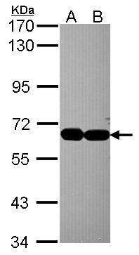 Anti-INTS4 antibody [N1N2], N-term used in Western blot. GTX116519