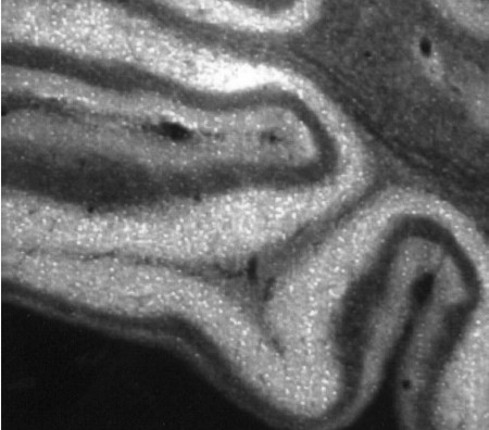 Anti-IP3 Receptor II antibody used in Immunohistochemistry. GTX82888