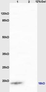 Anti-IQCJ antibody used in Western blot. GTX52020