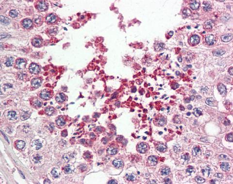 Anti-IRAK1BP1 antibody [N1C3] used in IHC (Formalin-fixed paraffin-embedded sections). GTX104392