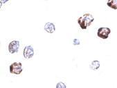 Anti-IRGC antibody used in ICC/IF. GTX85258