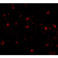 Anti-IRGC antibody used in ICC/IF. GTX85258